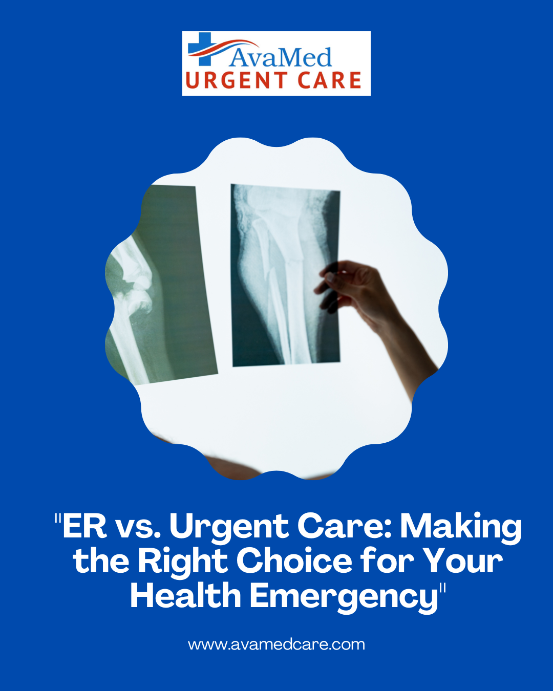 Er vs Urgent care Macon